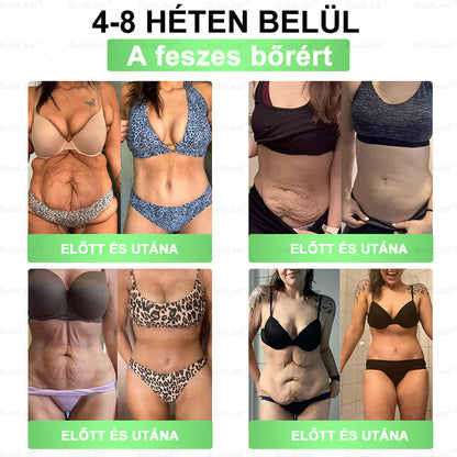 𝐁𝐮𝐢𝐥𝐝𝐋𝐞𝐚𝐟® 𝐆𝐋𝐏-𝟏 𝟖-𝐢𝐧-𝟏 𝐒𝐥𝐢𝐦 & 𝐇𝐞𝐚𝐥𝐭𝐡𝐲 𝐎𝐫á𝐥𝐢𝐬 𝐌𝐞𝐠𝐨𝐥𝐝á𝐬 ✨🌿 𝐓á𝐦𝐨𝐠𝐚𝐭𝐣𝐚 𝐚𝐳 𝐞𝐥𝐡í𝐳á𝐬 𝐤𝐞𝐳𝐞𝐥é𝐬é𝐭, 𝐚 𝐬𝐳í𝐯- é𝐬 é𝐫𝐫𝐞𝐧𝐝𝐬𝐳𝐞𝐫𝐢 𝐞𝐠é𝐬𝐳𝐬é𝐠𝐞𝐭, 𝐚 𝐜𝐮𝐤𝐨𝐫𝐛𝐞𝐭𝐞𝐠𝐬é𝐠𝐞𝐭, 𝐚𝐳 𝐚𝐥𝐯á𝐬𝐢 𝐚𝐩𝐧𝐨é𝐭, 𝐚 𝐛é𝐥𝐫𝐞𝐧𝐝𝐬𝐳𝐞𝐫 𝐞𝐠é𝐬𝐳𝐬é𝐠é𝐭, 𝐦𝐢𝐤ö𝐳𝐛𝐞𝐧 𝐟𝐞𝐬𝐳𝐞𝐬í𝐭𝐢 𝐚 𝐛ő𝐫𝐭 é𝐬 𝐧ö𝐯𝐞𝐥𝐢 𝐚𝐳 𝐞𝐧𝐞𝐫𝐠𝐢á𝐭 🎉🤝